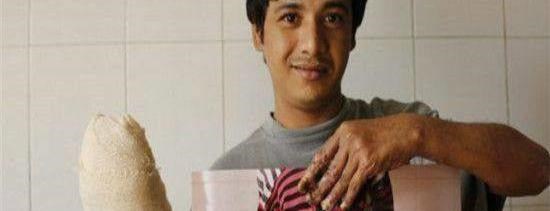 印度一男子得怪病,长满树枝,妻子生完两个孩子后,弃他而去!_图2 印度一男子得怪病,长满树枝,妻子生完两个孩子后,弃他而去!_图2